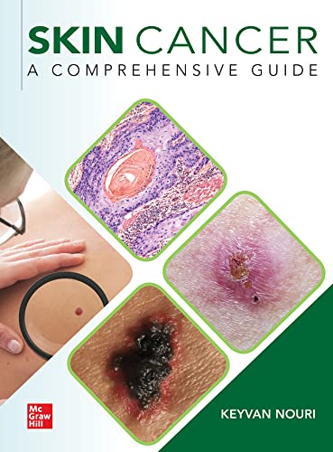 Imagen de archivo de Skin Cancer: A Comprehensive Guide a la venta por PBShop.store US