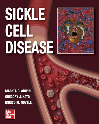 Stock image for Sickle Cell Disease for sale by ThriftBooks-Atlanta