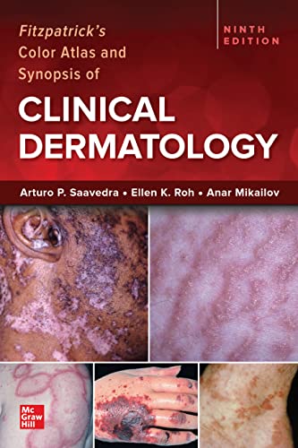 Stock image for FITZPATRICK'S COLOR ATLAS & SYNOPSIS OF CLINICAL DERMA ,9/ED (IE) for sale by Romtrade Corp.