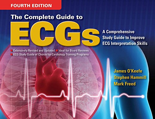 9781284066340: Complete Guide to ECG's