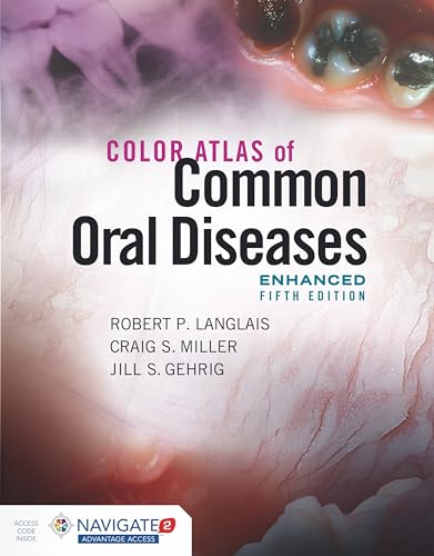 Imagen de archivo de Color Atlas of Common Oral Diseases, Enhanced Edition a la venta por BooksRun