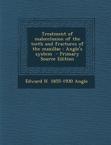9781287875994: Treatment of malocclusion of the teeth and fractures of the maxillae: Angle's system