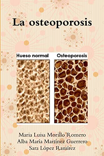 Stock image for La osteoporosis (Spanish Edition) for sale by California Books