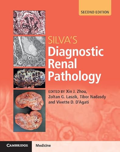 9781316613986: Silva's Diagnostic Renal Pathology