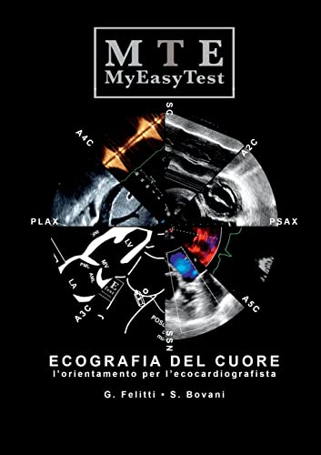 Stock image for Ecografia del Cuore - MyEasyTest (Italian Edition) for sale by Lucky's Textbooks
