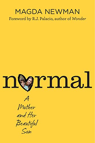 Beispielbild fr Normal: A Mother and Her Beautiful Son zum Verkauf von SecondSale