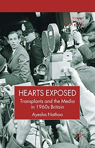 Beispielbild fr Hearts Exposed : Transplants and the Media in 1960s Britain zum Verkauf von Chiron Media