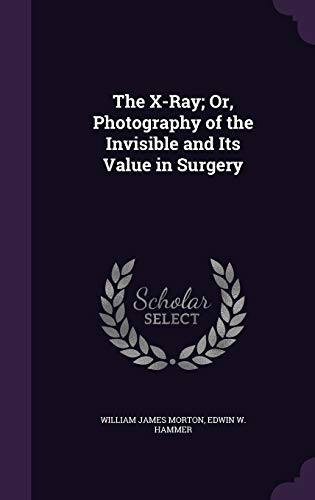 9781358355363: The X-Ray; Or, Photography of the Invisible and Its Value in Surgery