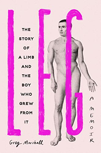 Beispielbild fr Leg: The Story of a Limb and the Boy Who Grew from It zum Verkauf von WorldofBooks