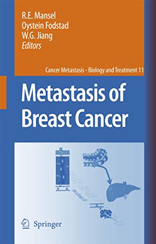 9781402058660: Metastasis of Breast Cancer: 11