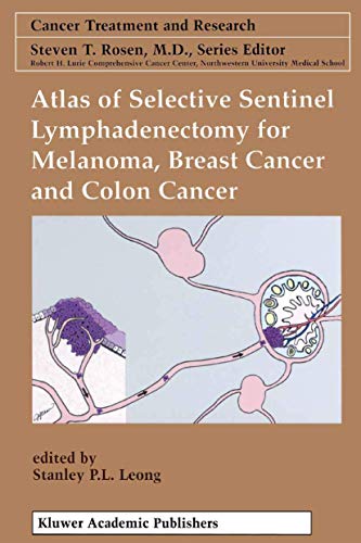 Atlas Of Selective Sentinel Lymphadenectomy For Melanoma, Breast Cancer And Colon Cancer (cancer ...