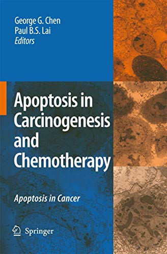 Beispielbild fr Apoptosis In Carcinogenesis And Chemotherapy zum Verkauf von Basi6 International