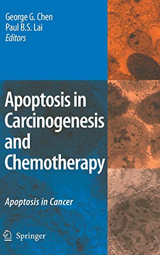 9781402095962: Apoptosis in Carcinogenesis and Chemotherapy: Apoptosis in Cancer