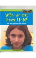 Imagen de archivo de Why Do My Eyes Itch?: And Other Questions About Allergies (Body Matters) a la venta por SecondSale