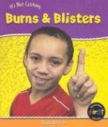 Imagen de archivo de Burns and Blisters a la venta por Better World Books