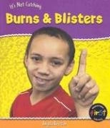 9781403448248: Burns and Blisters (Heinemann First Library)