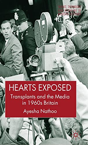 9781403987303: Hearts Exposed: Transplants and the Media in 1960s Britain