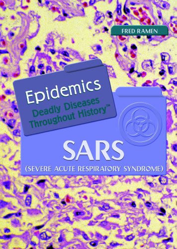 Stock image for SARS: (Severe Acute Respiratory Syndrome) (EPIDEMICS) for sale by HPB-Emerald
