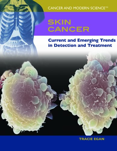 9781404203907: Skin Cancer: Current And Emerging Trends in Detection And Treatment (Cancer & Modern Science)