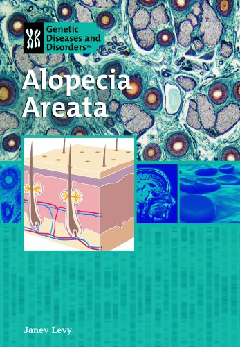 Beispielbild fr Alopecia Areata zum Verkauf von Better World Books