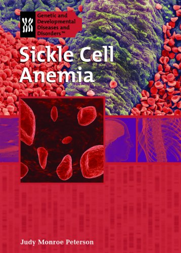 Beispielbild fr Sickle Cell Anemia (Genetic and Developmental Diseases and Disorders) zum Verkauf von More Than Words