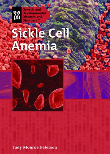 Stock image for Sickle Cell Anemia (Genetic and Developmental Diseases and Disorders) for sale by More Than Words