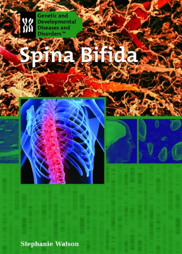 9781404218536: Spina Bifida (Genetic and Developmental Diseases and Disorders)