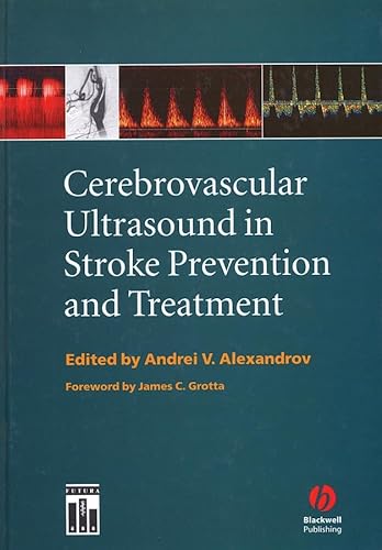 9781405103817: Cerebrovascular Ultrasound in Stroke Prevention and Treatment