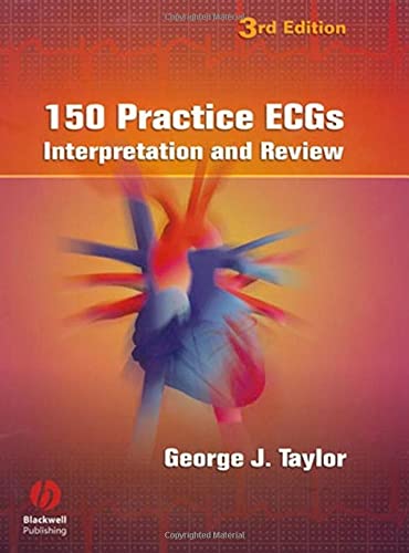 9781405104838: 150 Practice ECGs: Interpretation And Review