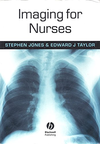 Imagen de archivo de Imaging for Nurses a la venta por Better World Books
