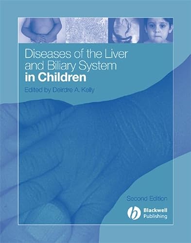 Beispielbild fr Diseases of the Liver and Biliary System in Children zum Verkauf von WorldofBooks