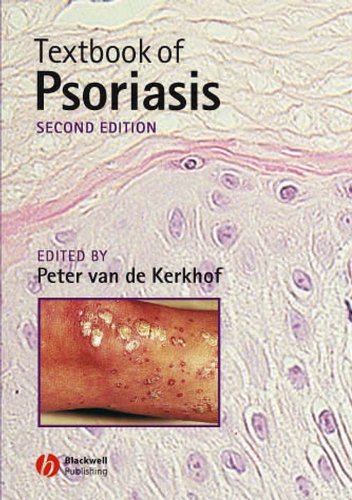 Beispielbild fr Textbook of Psoriasis zum Verkauf von medimops