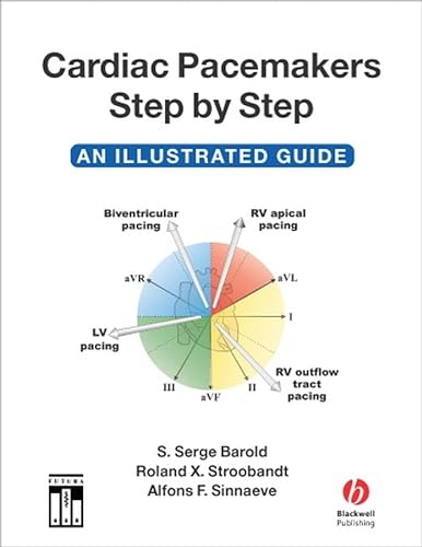 Stock image for Cardiac Pacemakers Step-by-Step: An Illustrated Guide for sale by Seattle Goodwill