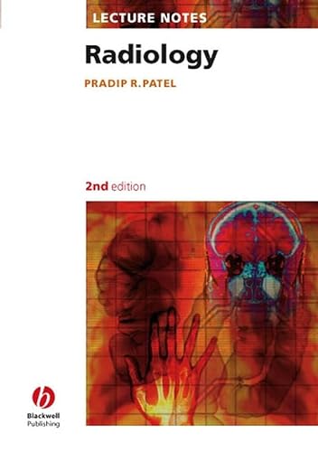 Beispielbild fr Lecture Notes Radiology zum Verkauf von WorldofBooks
