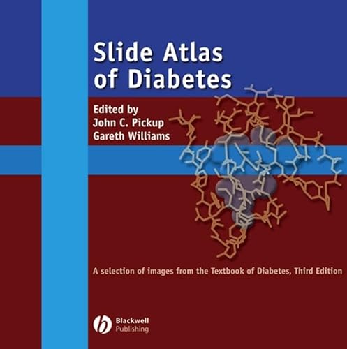Slide Atlas of Diabetes, CD-ROM: A Selection of Images from the Textbook of Diabetes (9781405126182) by Pickup, John C.; Williams, Gareth