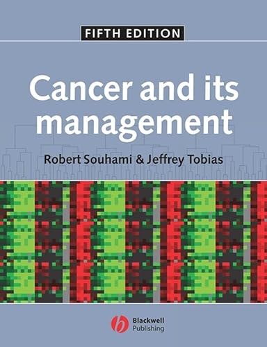 Stock image for Cancer and its Management for sale by WorldofBooks