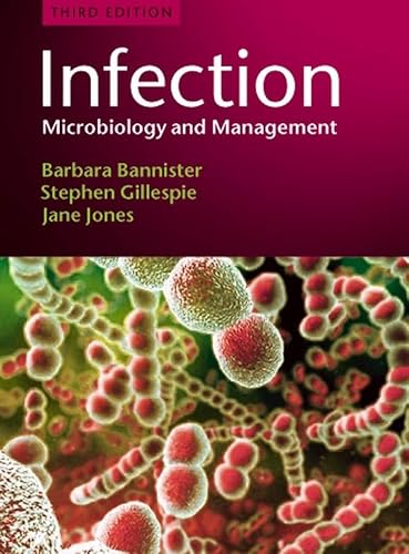 Imagen de archivo de Infection : Microbiology and Management a la venta por Better World Books: West