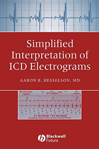 Stock image for Simplified Interpretation of ICD Electrograms for sale by Chiron Media
