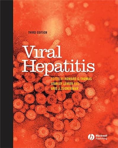 Stock image for Viral Hepatitis for sale by Anybook.com