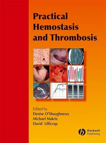 Stock image for Practical Hemostasis and Thrombosis for sale by WorldofBooks