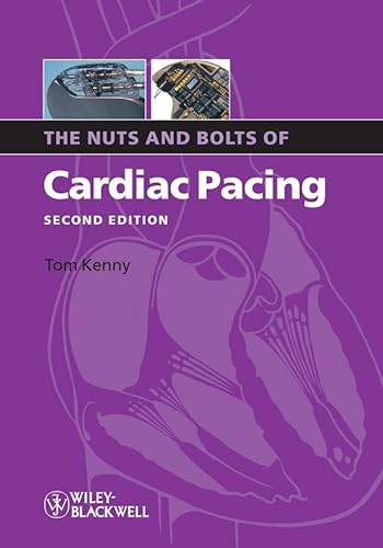 Imagen de archivo de The Nuts and Bolts of Cardiac Pacing (Nuts and Bolts Series (Replaced by 5113)) a la venta por Books Unplugged