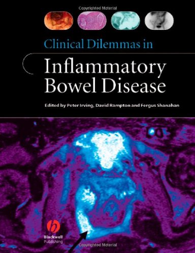 Beispielbild fr Clinical Dilemmas in Inflammatory Bowel Disease (Clinical Dilemmas (UK)) zum Verkauf von WorldofBooks