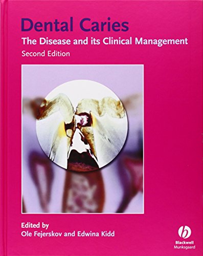 Imagen de archivo de Dental Caries: The Disease and Its Clinical Management a la venta por ZBK Books