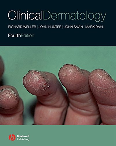 Stock image for Clinical Dermatology for sale by Open Books