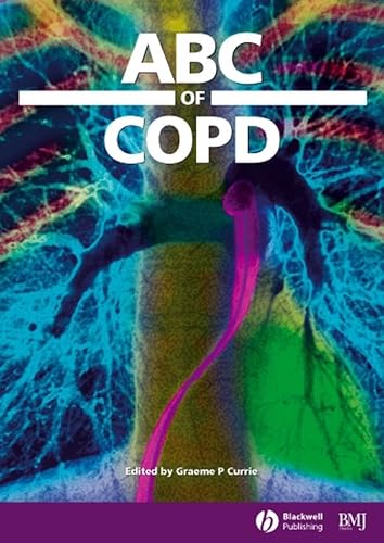 Beispielbild fr ABC of COPD (ABC Series) zum Verkauf von WorldofBooks