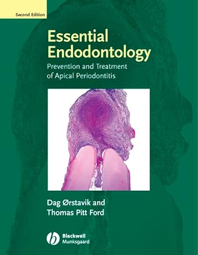 Stock image for Essential Endodontology : Prevention and Treatment of Apical Periodontitis for sale by Better World Books Ltd