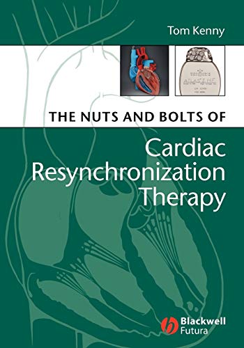 Beispielbild fr The Nuts and Bolts of Cardiac Resynchronization Therapy zum Verkauf von Blackwell's