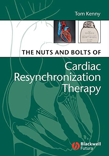 Stock image for The Nuts and Bolts of Cardiac Resynchronization Therapy for sale by HPB-Red