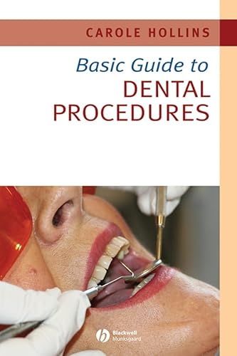 Stock image for Basic Guide to Dental Procedures for sale by ThriftBooks-Atlanta
