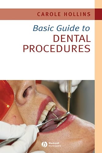 Stock image for Basic Guide to Dental Procedures for sale by Better World Books